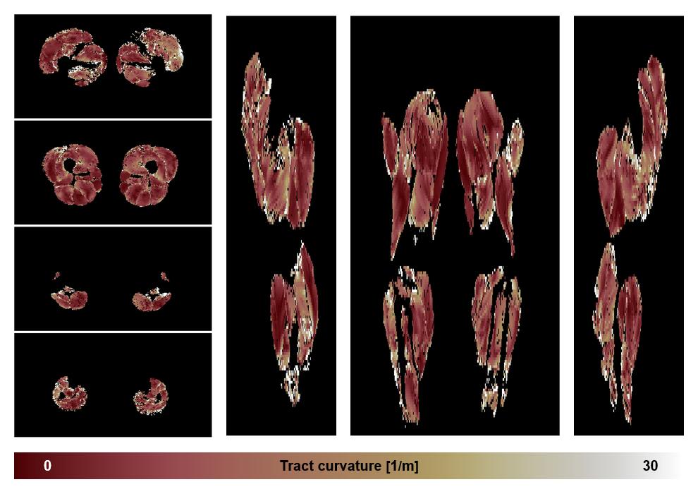 Muscle fiber tract curvature map based on whole leg DTI based fiber tractography.