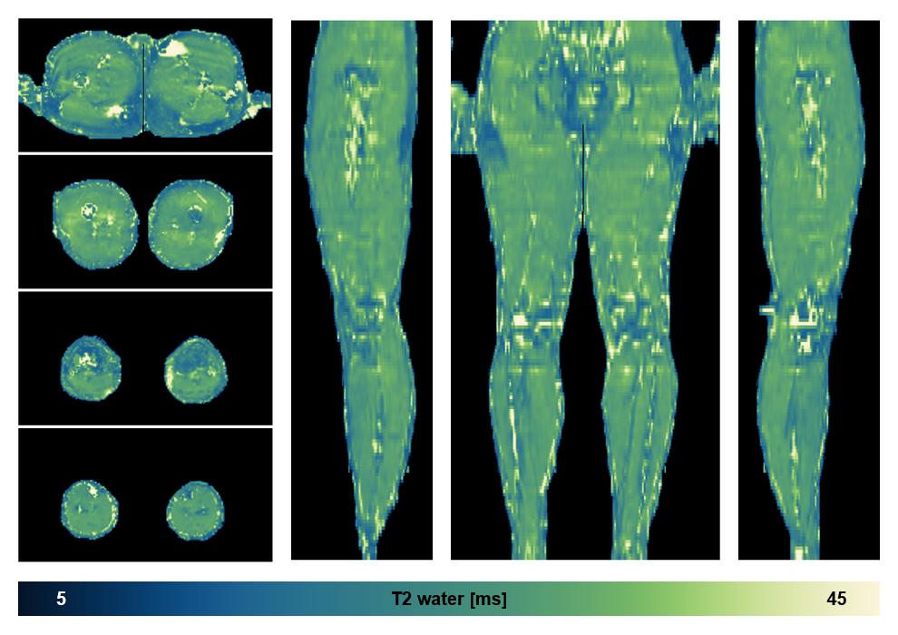 The water only T2 relaxation time of the lower extremity obtained from multi echo spin echo t2 mapping with EPG based reconstruction.