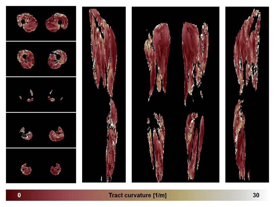 Muscle fiber tract curvature map based on whole leg DTI based fiber tractography.