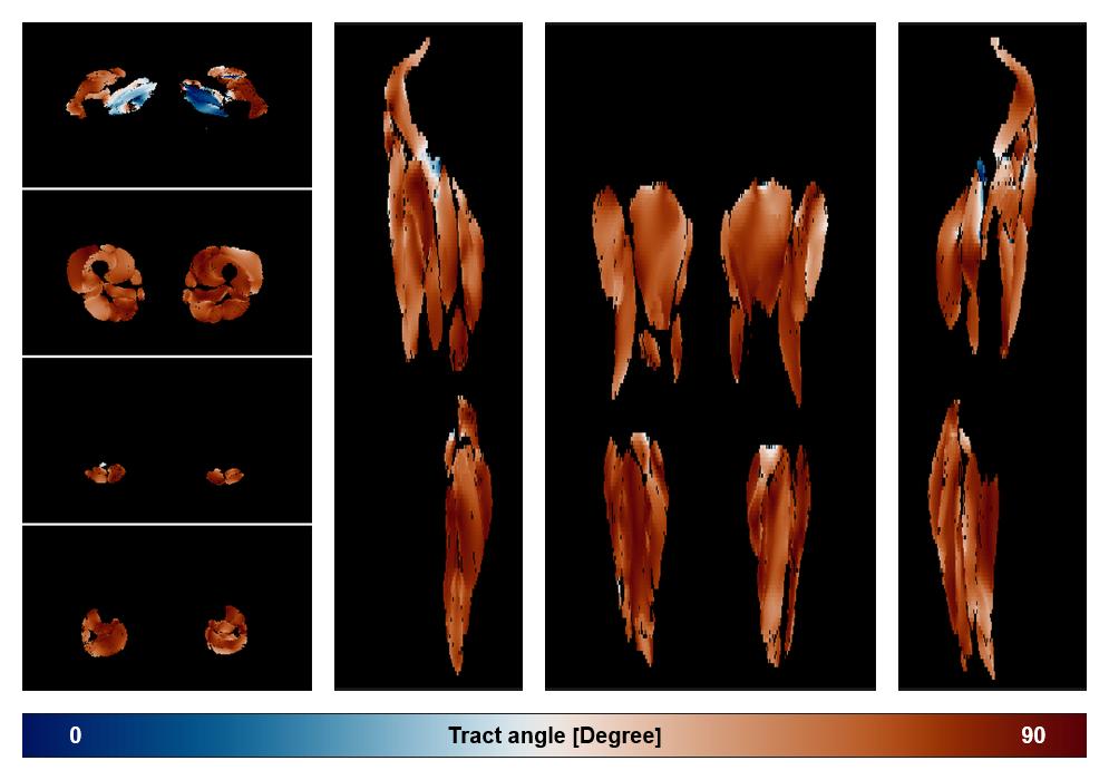 Muscle fiber tract angle map based on whole leg DTI based fiber tractography.