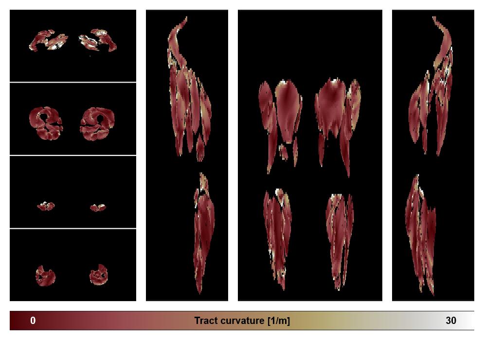 Muscle fiber tract curvature map based on whole leg DTI based fiber tractography.