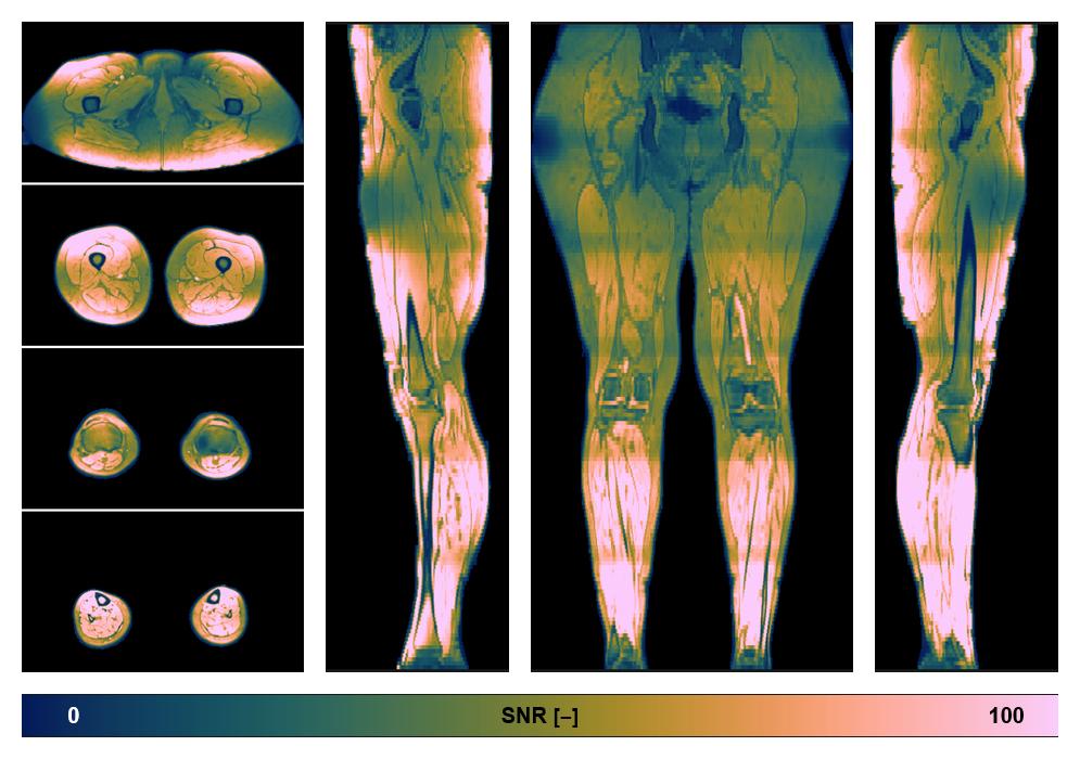 The SNR distribution of the dixon data.