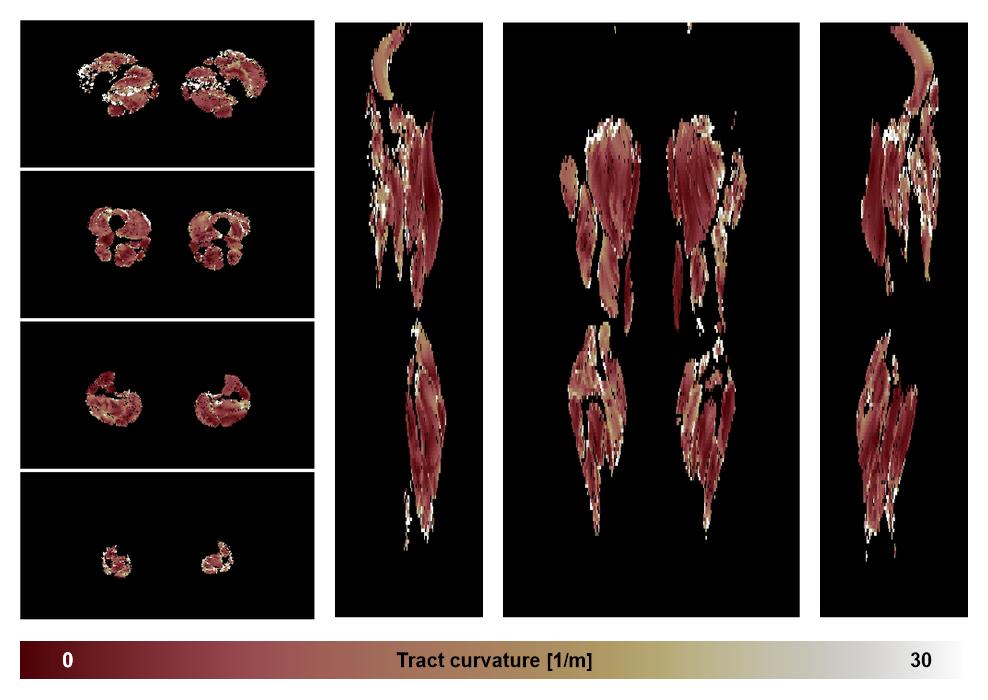 Muscle fiber tract curvature map based on whole leg DTI based fiber tractography.