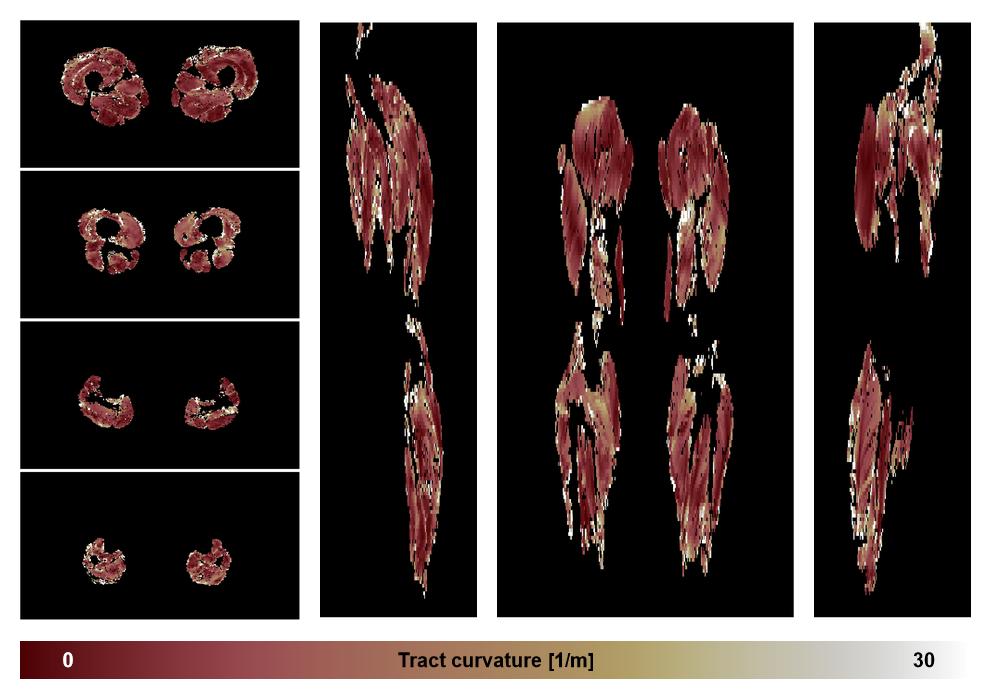 Muscle fiber tract curvature map based on whole leg DTI based fiber tractography.