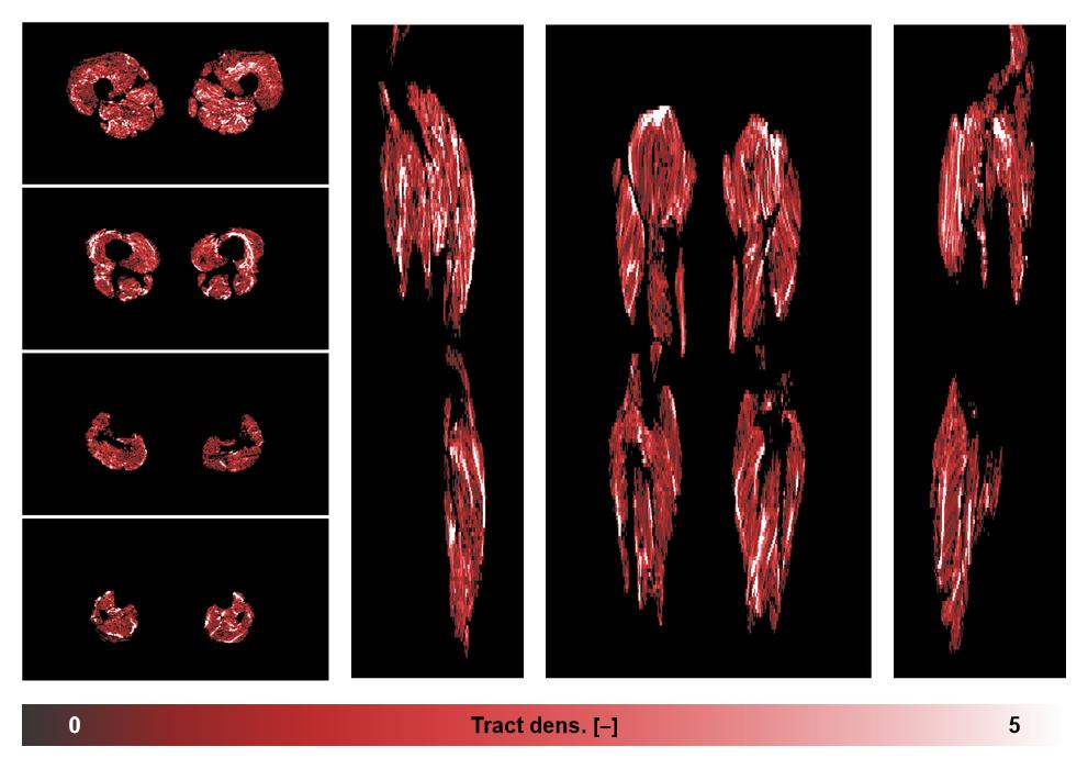 Muscle fiber tract density map based on whole leg DTI based fiber tractography.