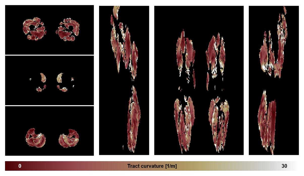 Muscle fiber tract curvature map based on whole leg DTI based fiber tractography.