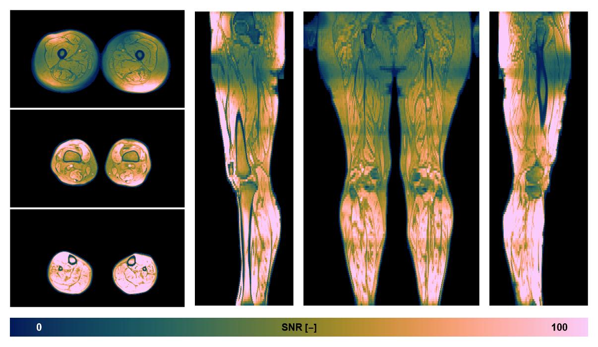 The SNR distribution of the dixon data.