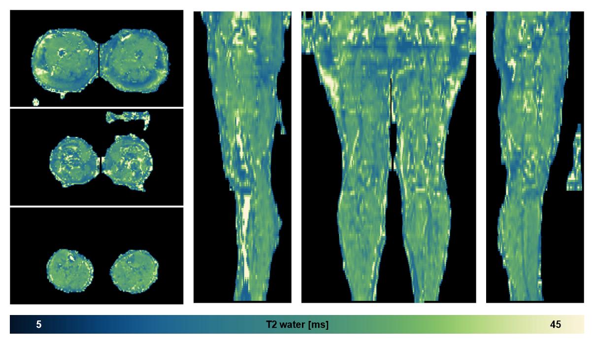 The water only T2 relaxation time of the lower extremity obtained from multi echo spin echo t2 mapping with EPG based reconstruction.