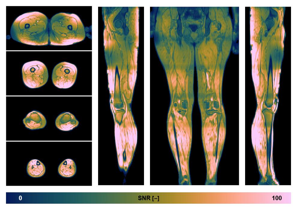 The SNR distribution of the dixon data.