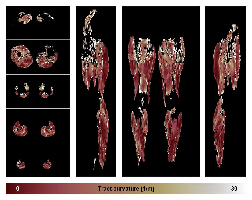 Muscle fiber tract curvature map based on whole leg DTI based fiber tractography.