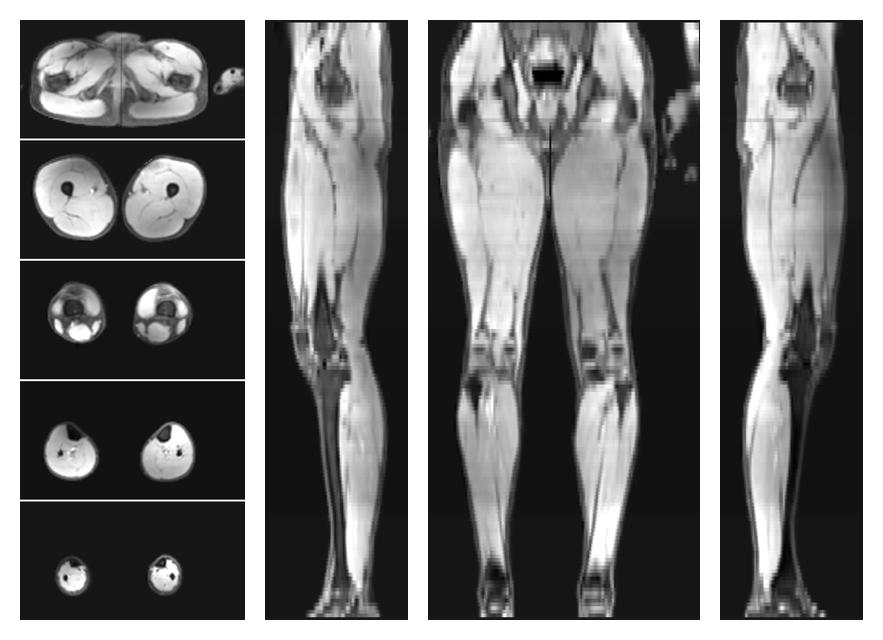 The water part of the acquired multi-echo spin echo data.