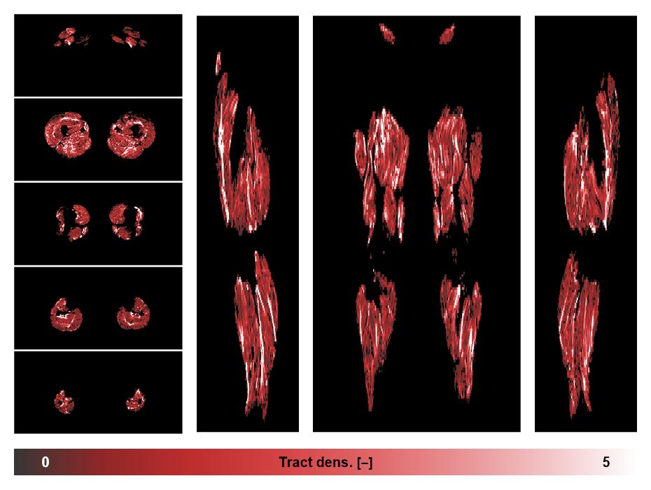 Muscle fiber tract density map based on whole leg DTI based fiber tractography.