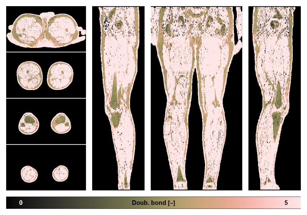 Number of double bonds in subcutanious fat.