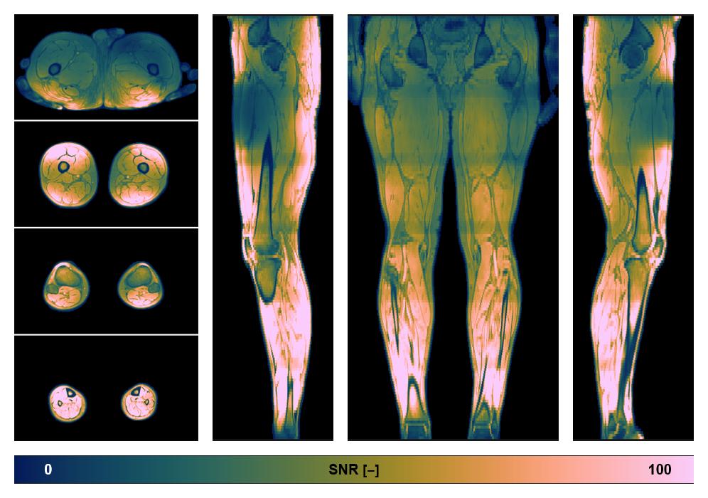 The SNR distribution of the dixon data.