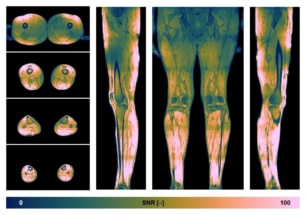 The SNR distribution of the dixon data.