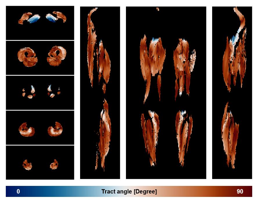 Muscle fiber tract angle map based on whole leg DTI based fiber tractography.