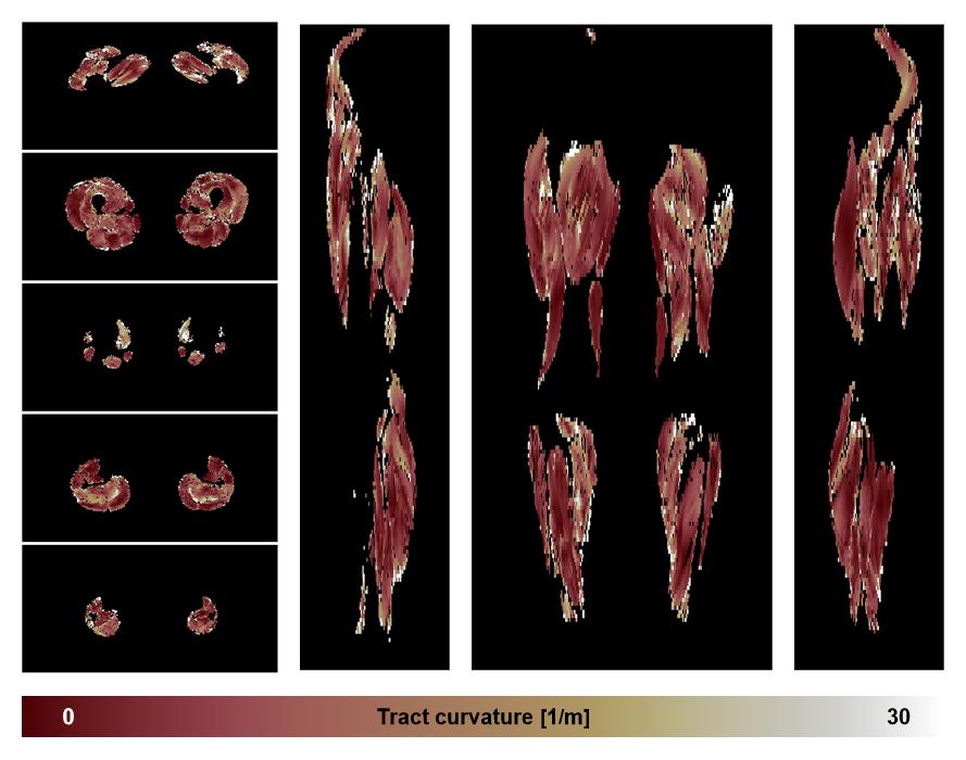 Muscle fiber tract curvature map based on whole leg DTI based fiber tractography.