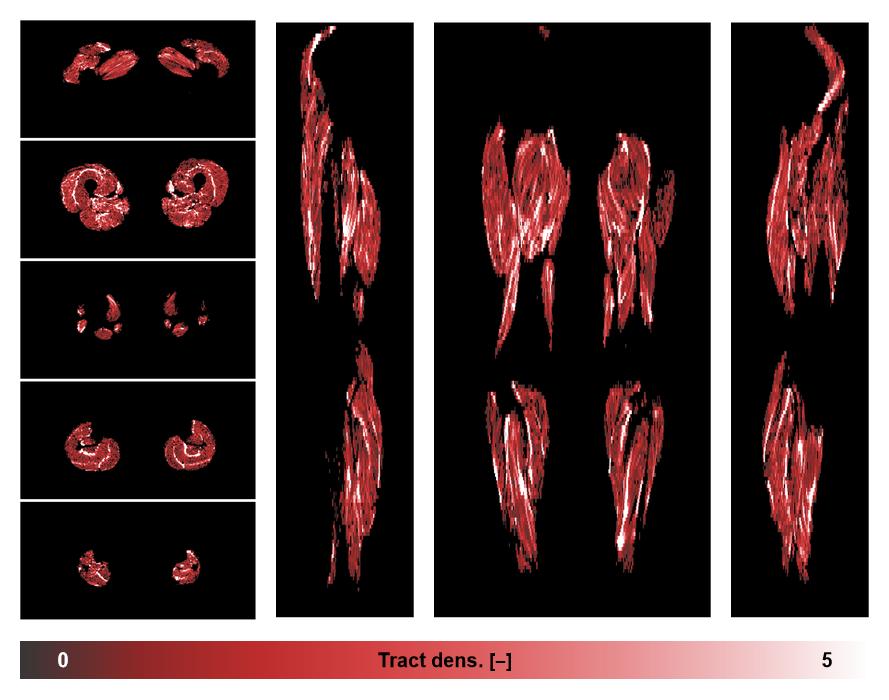 Muscle fiber tract density map based on whole leg DTI based fiber tractography.