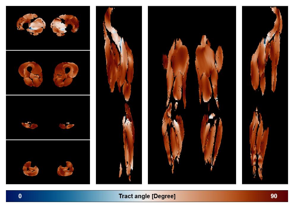 Muscle fiber tract angle map based on whole leg DTI based fiber tractography.