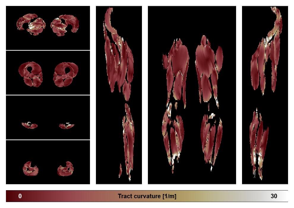 Muscle fiber tract curvature map based on whole leg DTI based fiber tractography.