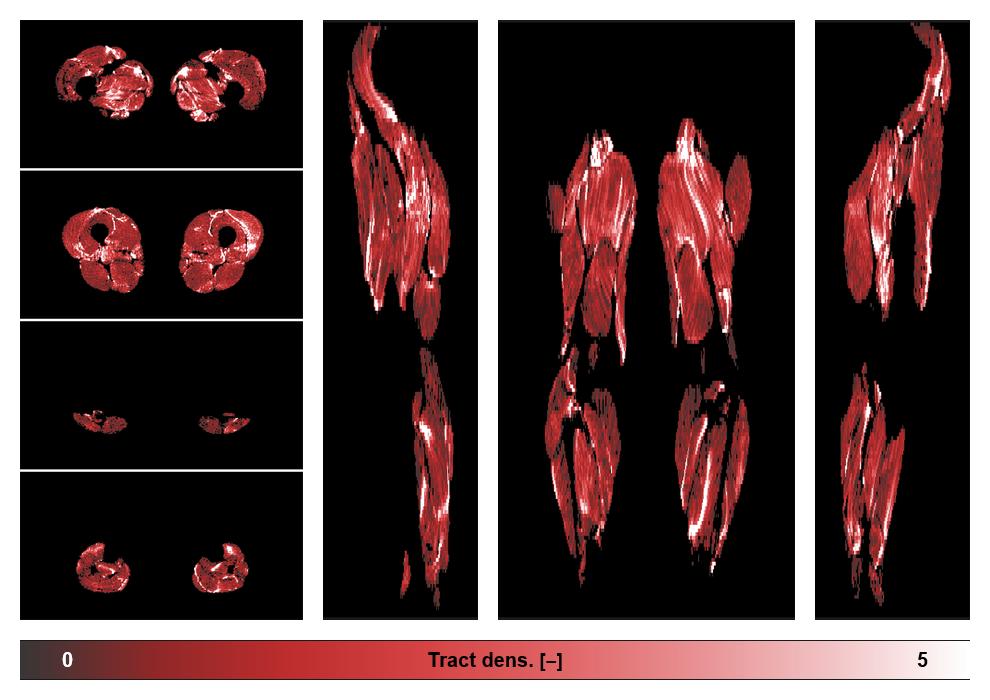 Muscle fiber tract density map based on whole leg DTI based fiber tractography.
