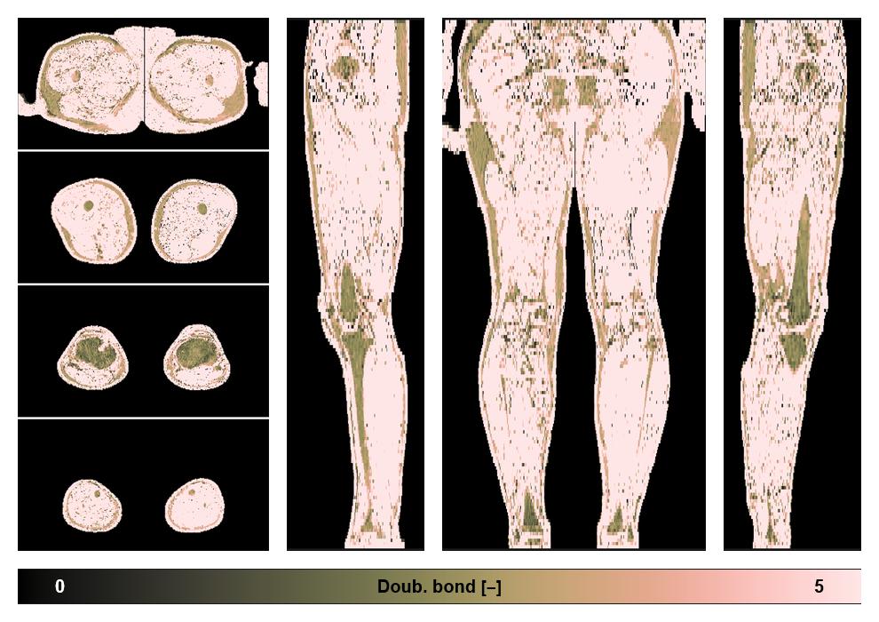 Number of double bonds in subcutanious fat.