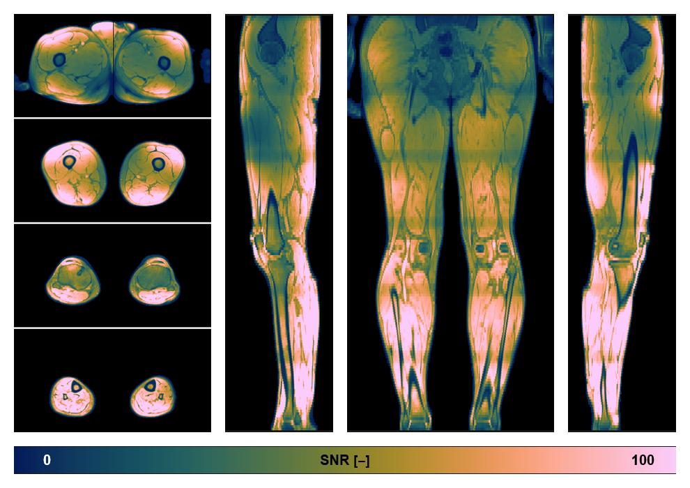 The SNR distribution of the dixon data.