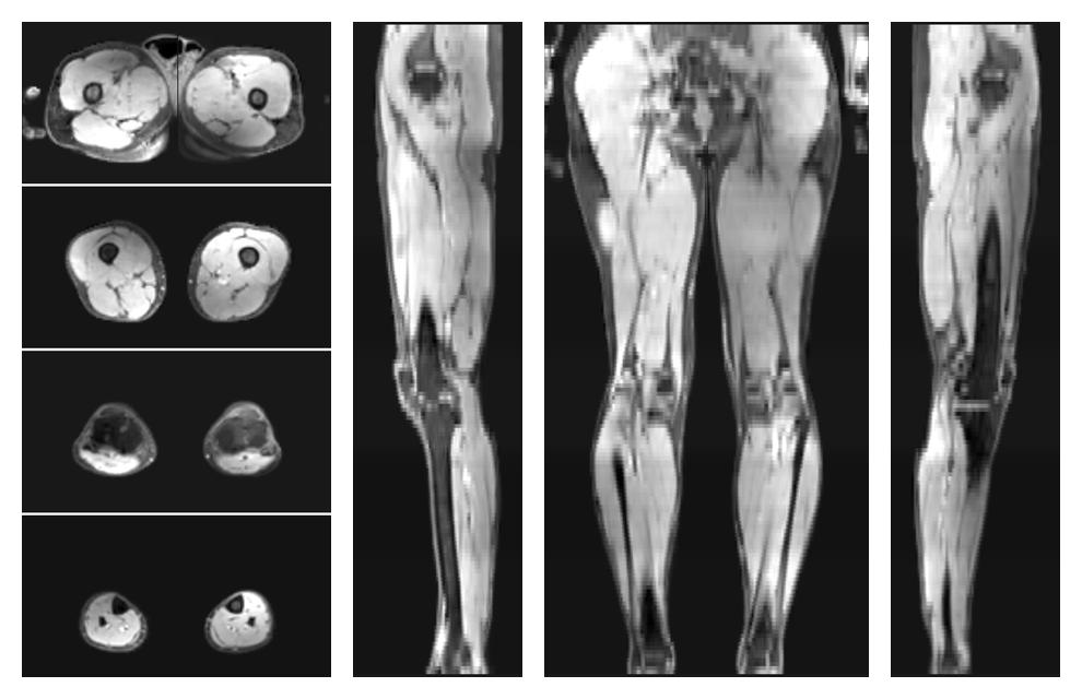The water part of the acquired multi-echo spin echo data.