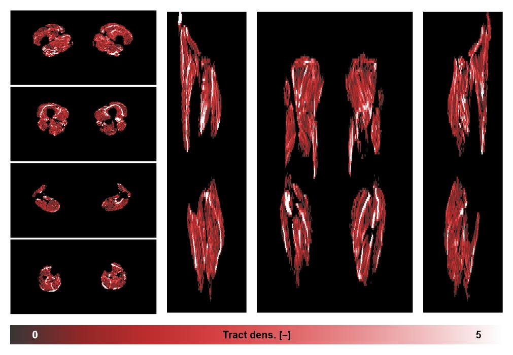 Muscle fiber tract density map based on whole leg DTI based fiber tractography.