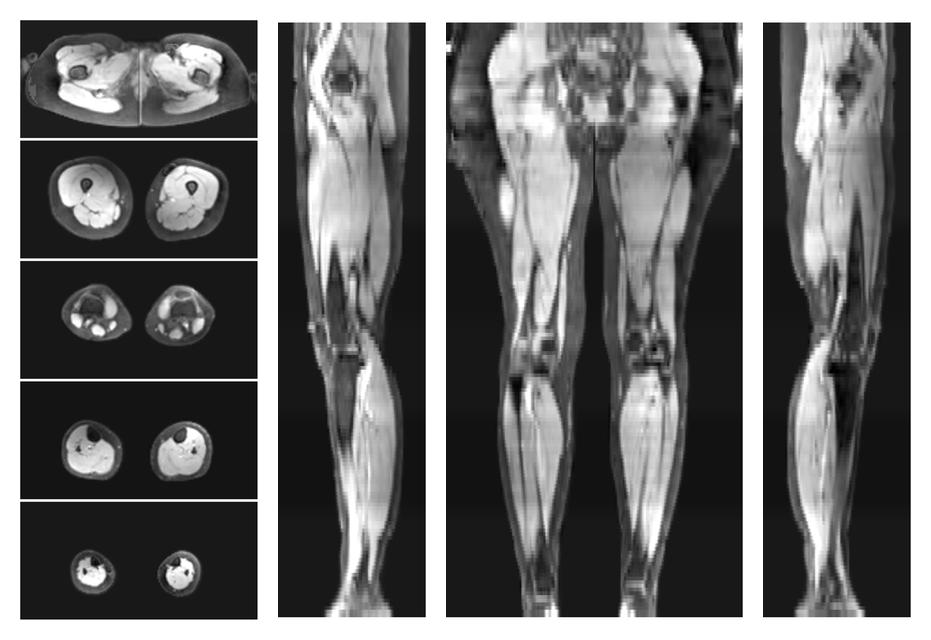 The water part of the acquired multi-echo spin echo data.