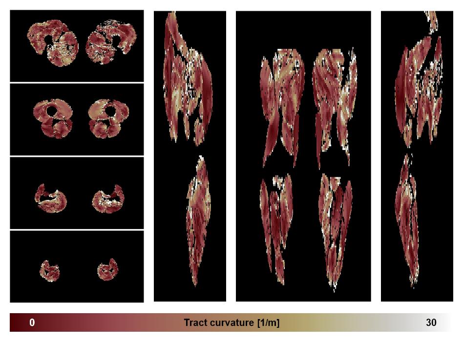Muscle fiber tract curvature map based on whole leg DTI based fiber tractography.