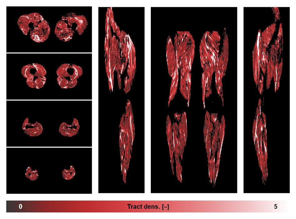 Muscle fiber tract density map based on whole leg DTI based fiber tractography.