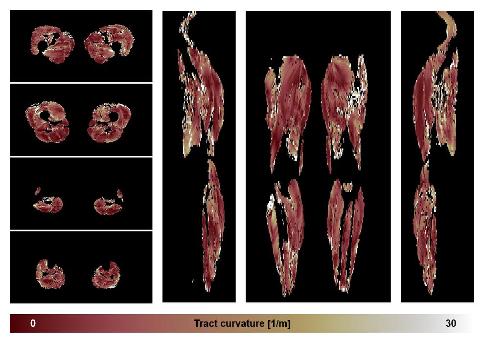 Muscle fiber tract curvature map based on whole leg DTI based fiber tractography.