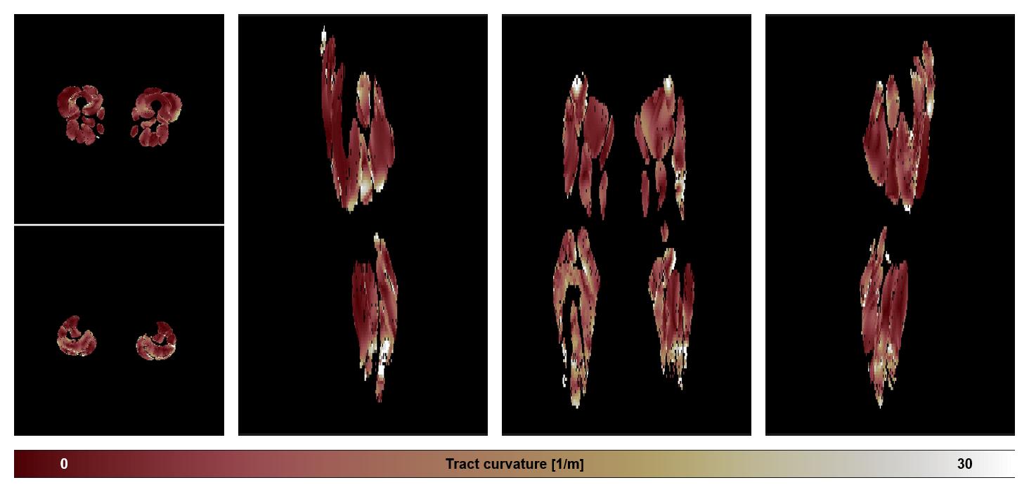 Muscle fiber tract curvature map based on whole leg DTI based fiber tractography.