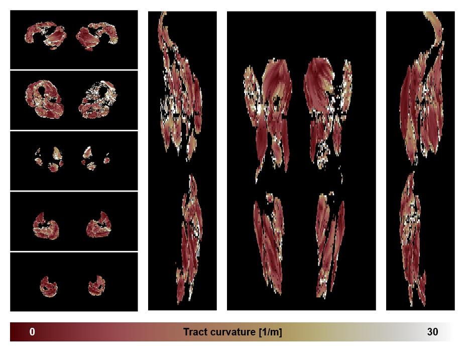 Muscle fiber tract curvature map based on whole leg DTI based fiber tractography.