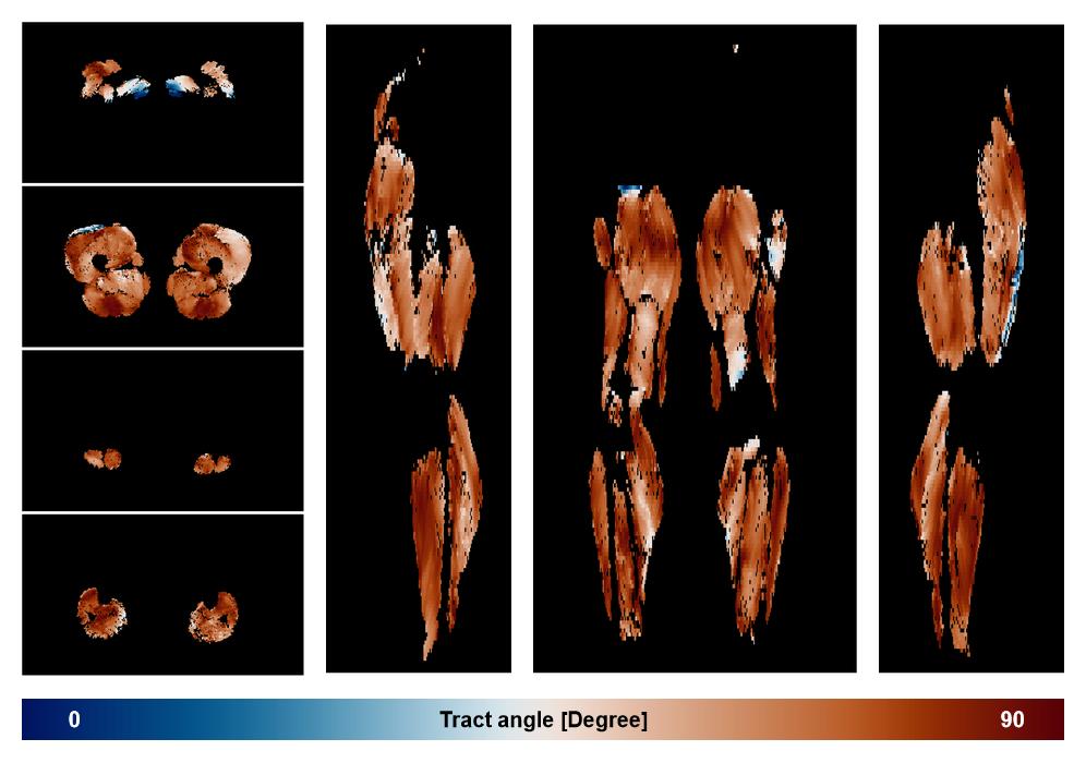 Muscle fiber tract angle map based on whole leg DTI based fiber tractography.