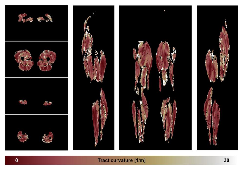 Muscle fiber tract curvature map based on whole leg DTI based fiber tractography.