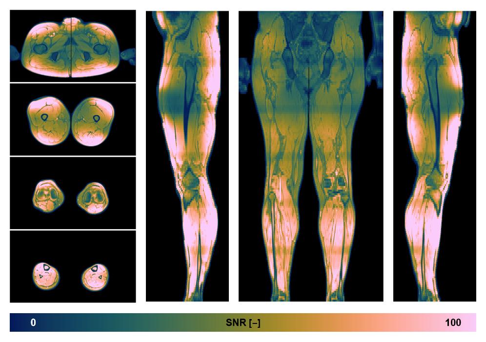 The SNR distribution of the dixon data.