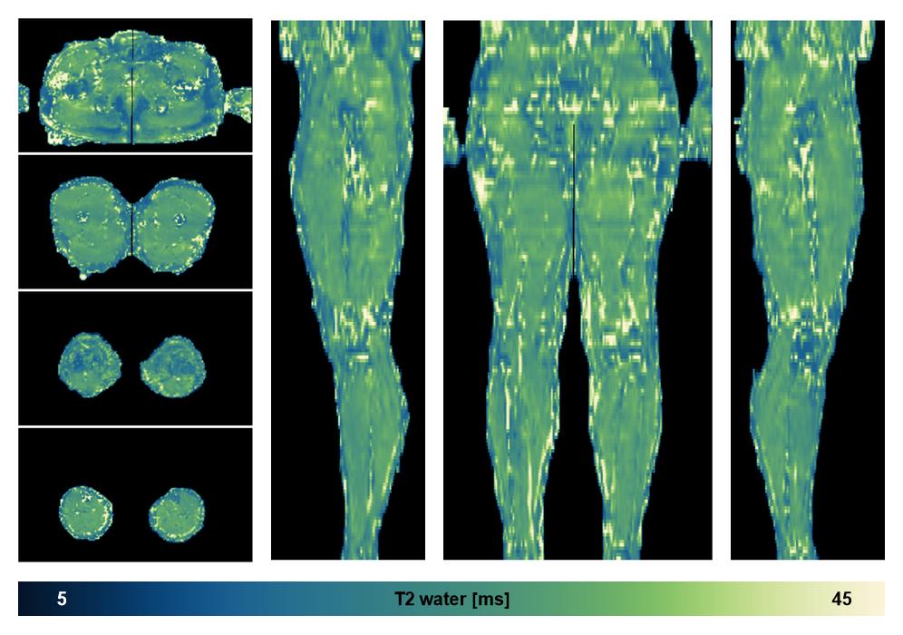 The water only T2 relaxation time of the lower extremity obtained from multi echo spin echo t2 mapping with EPG based reconstruction.