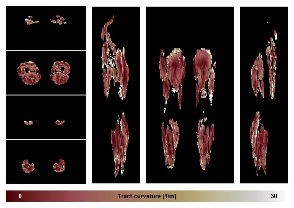 Muscle fiber tract curvature map based on whole leg DTI based fiber tractography.