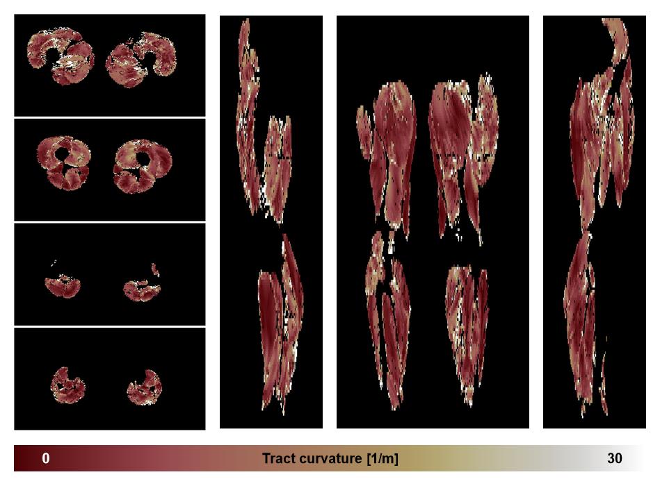 Muscle fiber tract curvature map based on whole leg DTI based fiber tractography.