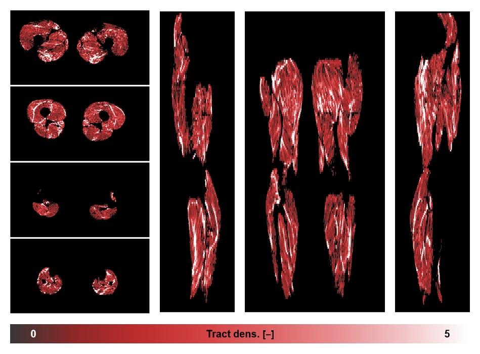 Muscle fiber tract density map based on whole leg DTI based fiber tractography.