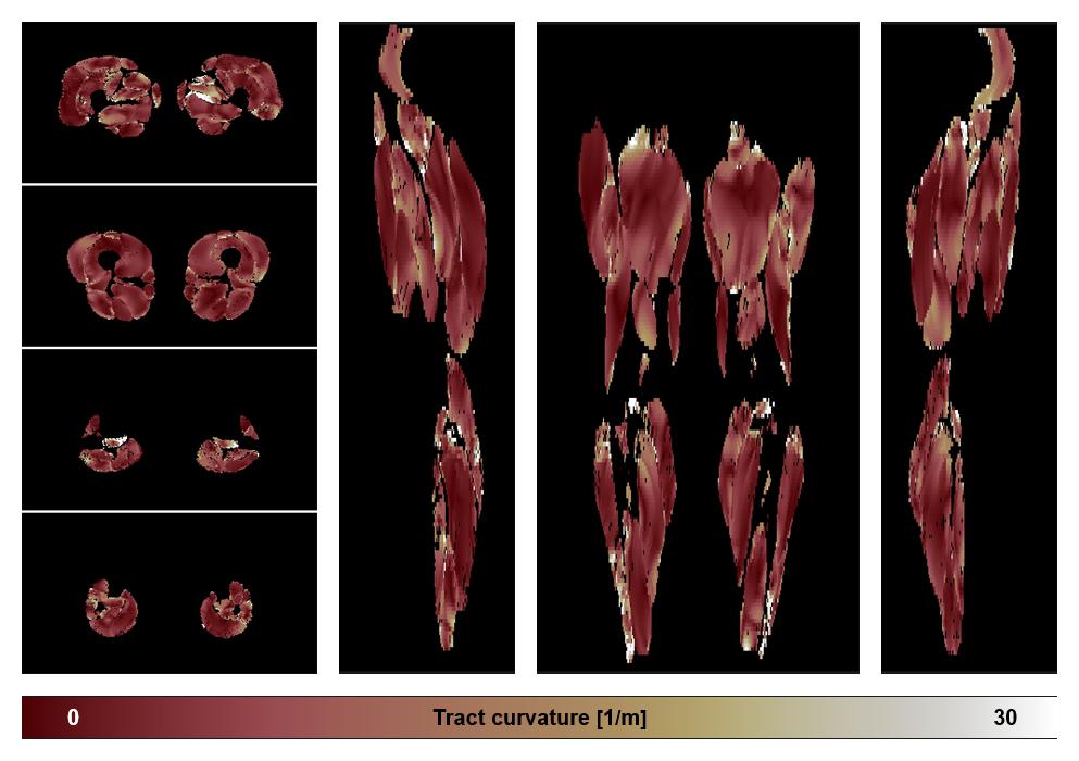 Muscle fiber tract curvature map based on whole leg DTI based fiber tractography.