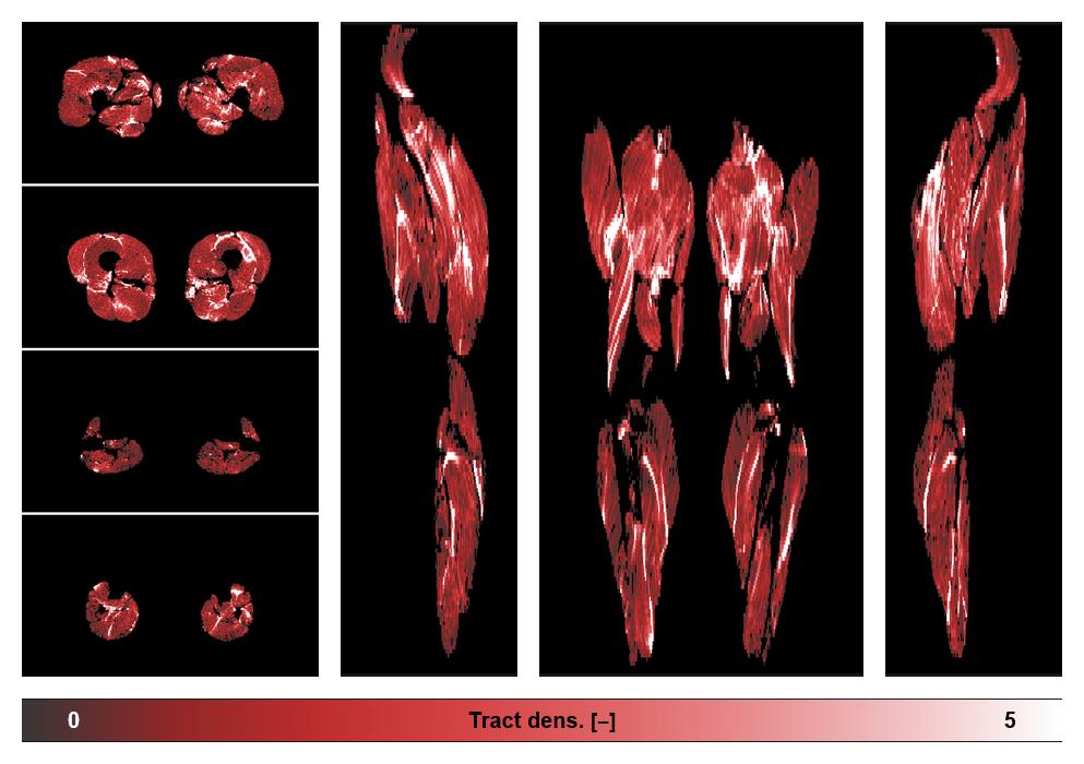 Muscle fiber tract density map based on whole leg DTI based fiber tractography.