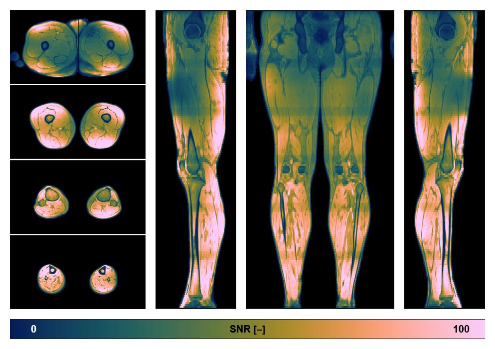The SNR distribution of the dixon data.
