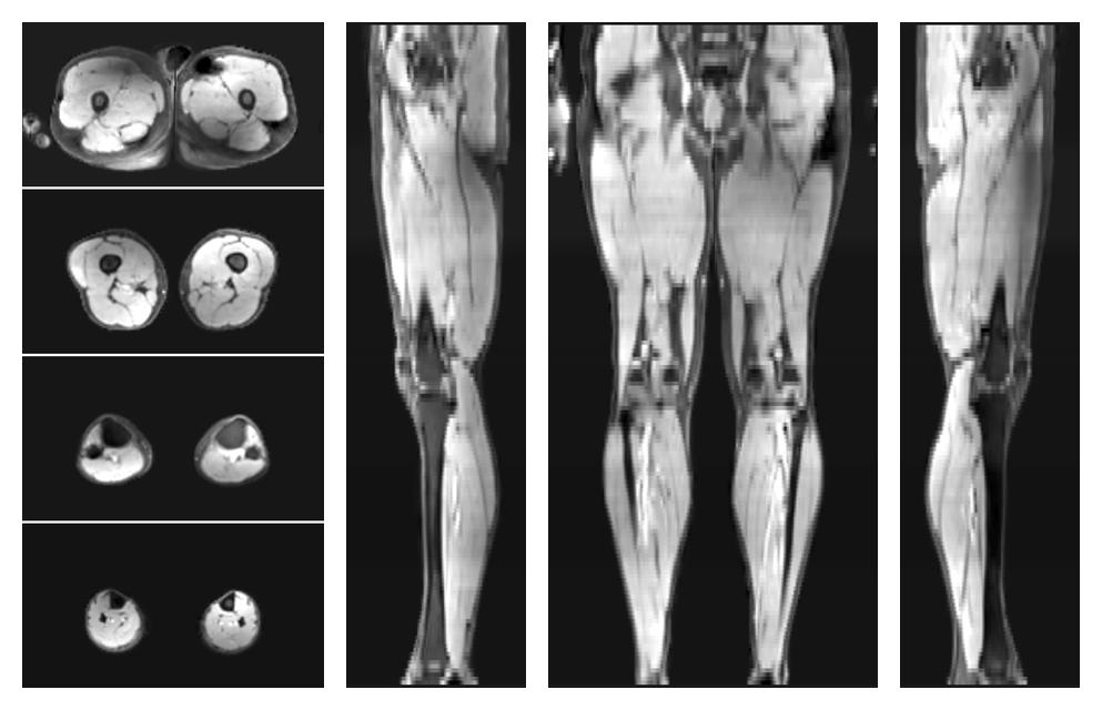 The water part of the acquired multi-echo spin echo data.