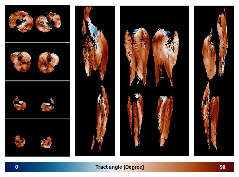 Muscle fiber tract angle map based on whole leg DTI based fiber tractography.