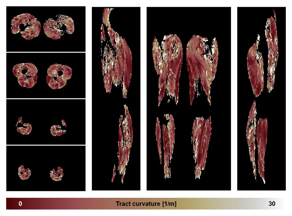 Muscle fiber tract curvature map based on whole leg DTI based fiber tractography.