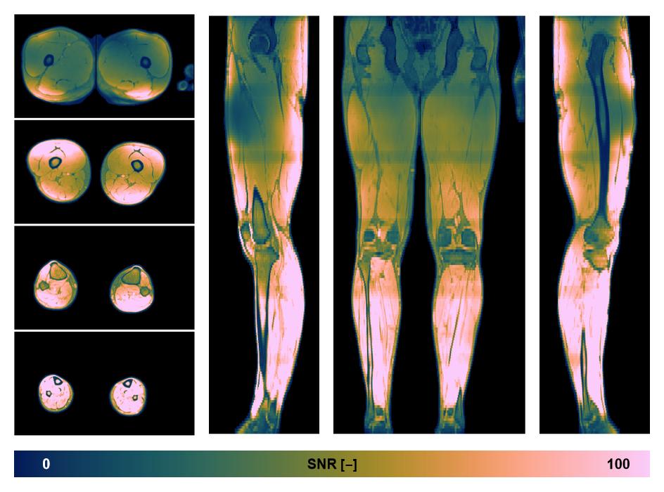 The SNR distribution of the dixon data.