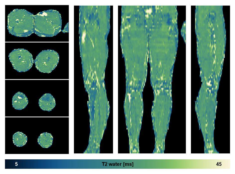 The water only T2 relaxation time of the lower extremity obtained from multi echo spin echo t2 mapping with EPG based reconstruction.